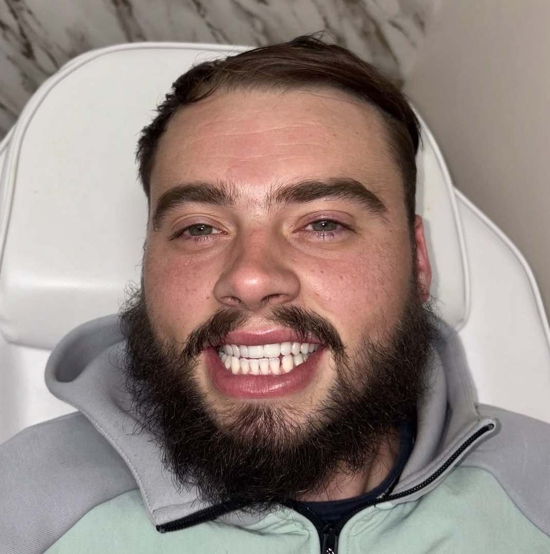 Lou Chubz smiling after a teeth brightening session at Glow Whitez