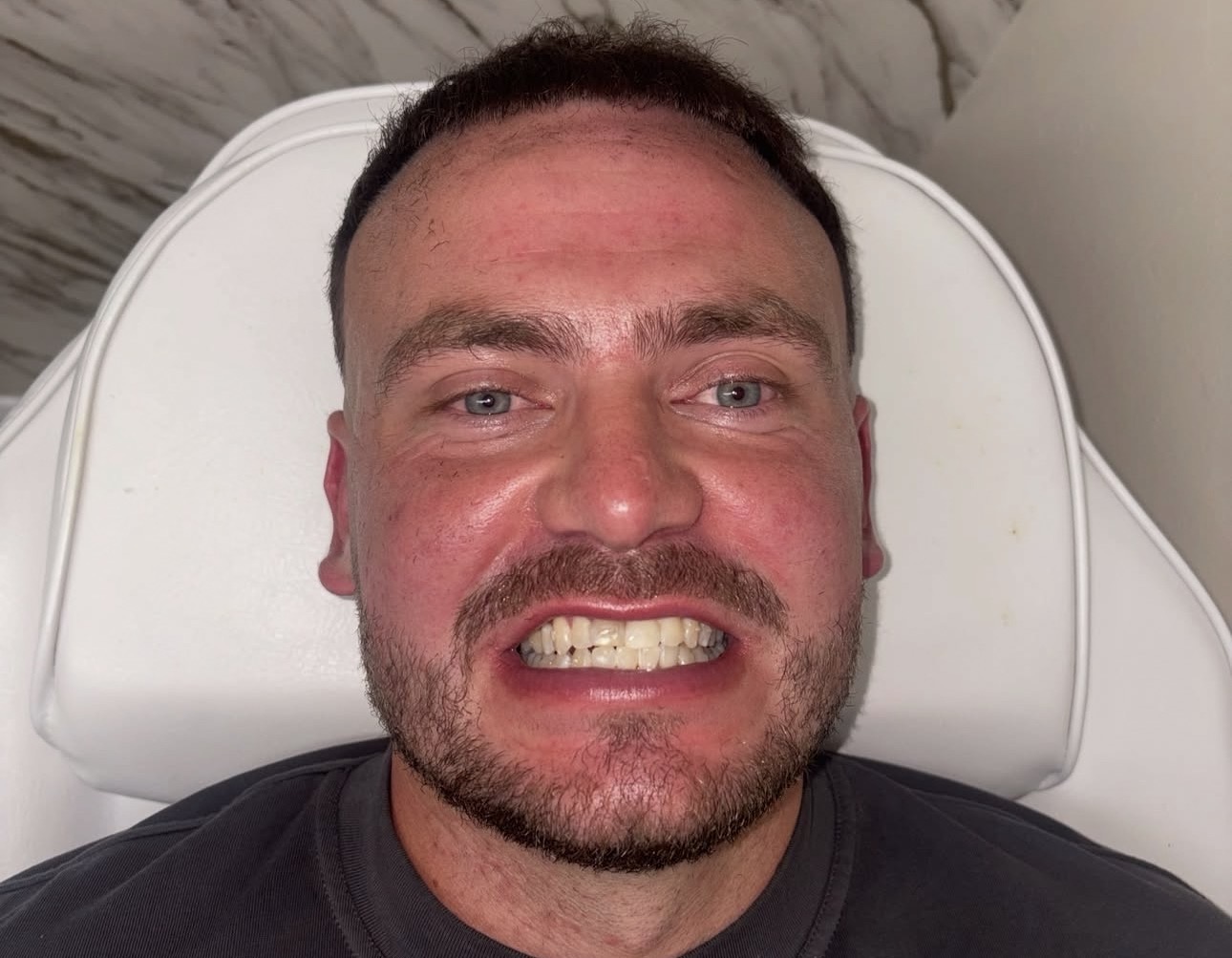 A client relaxing in the treatment chair before a brightening session