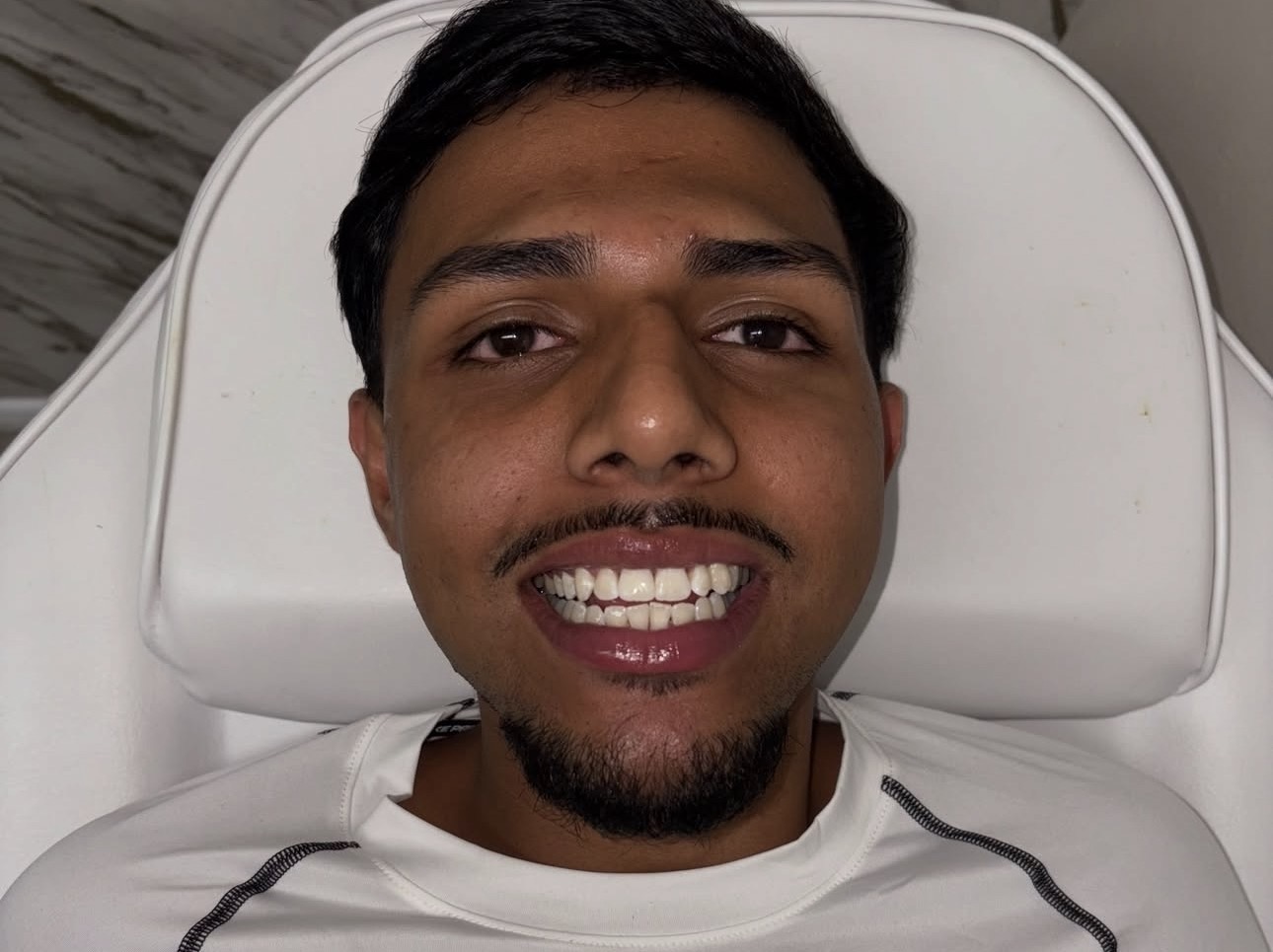 A client smiling after a teeth brightening session
