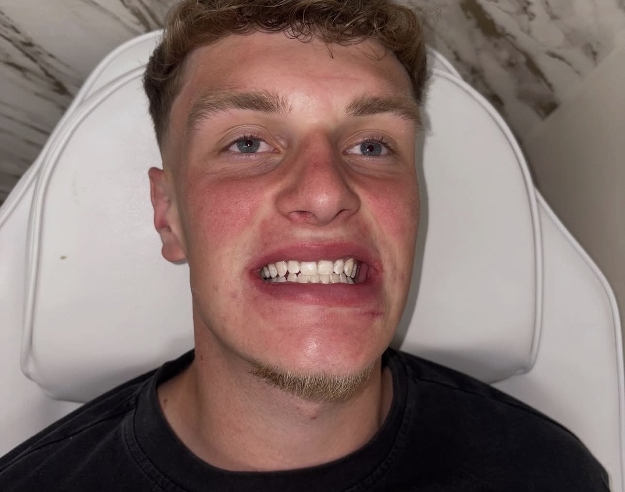 A client smiling in the treatment chair at Glow Whitez